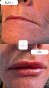 f3cfef68-d526-4493-b176-450c890ab506